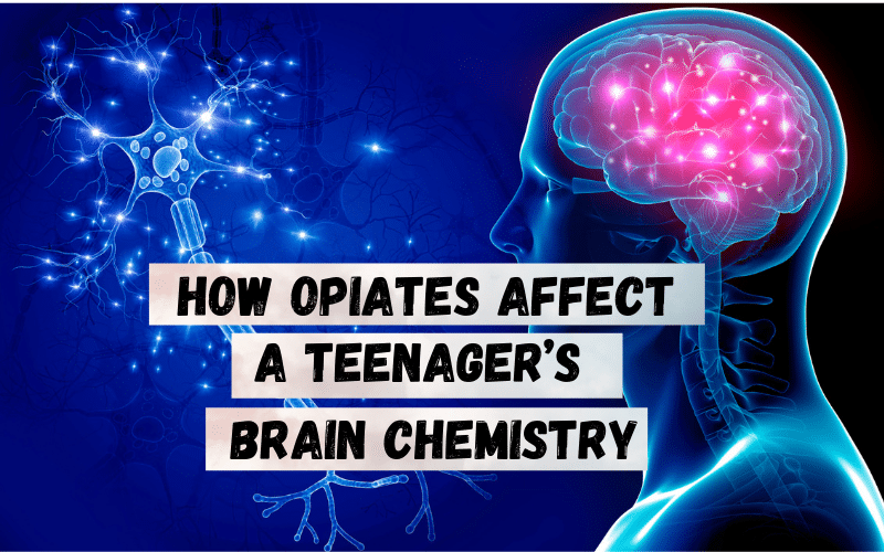 how opiates affect a teenagers brain chemistry